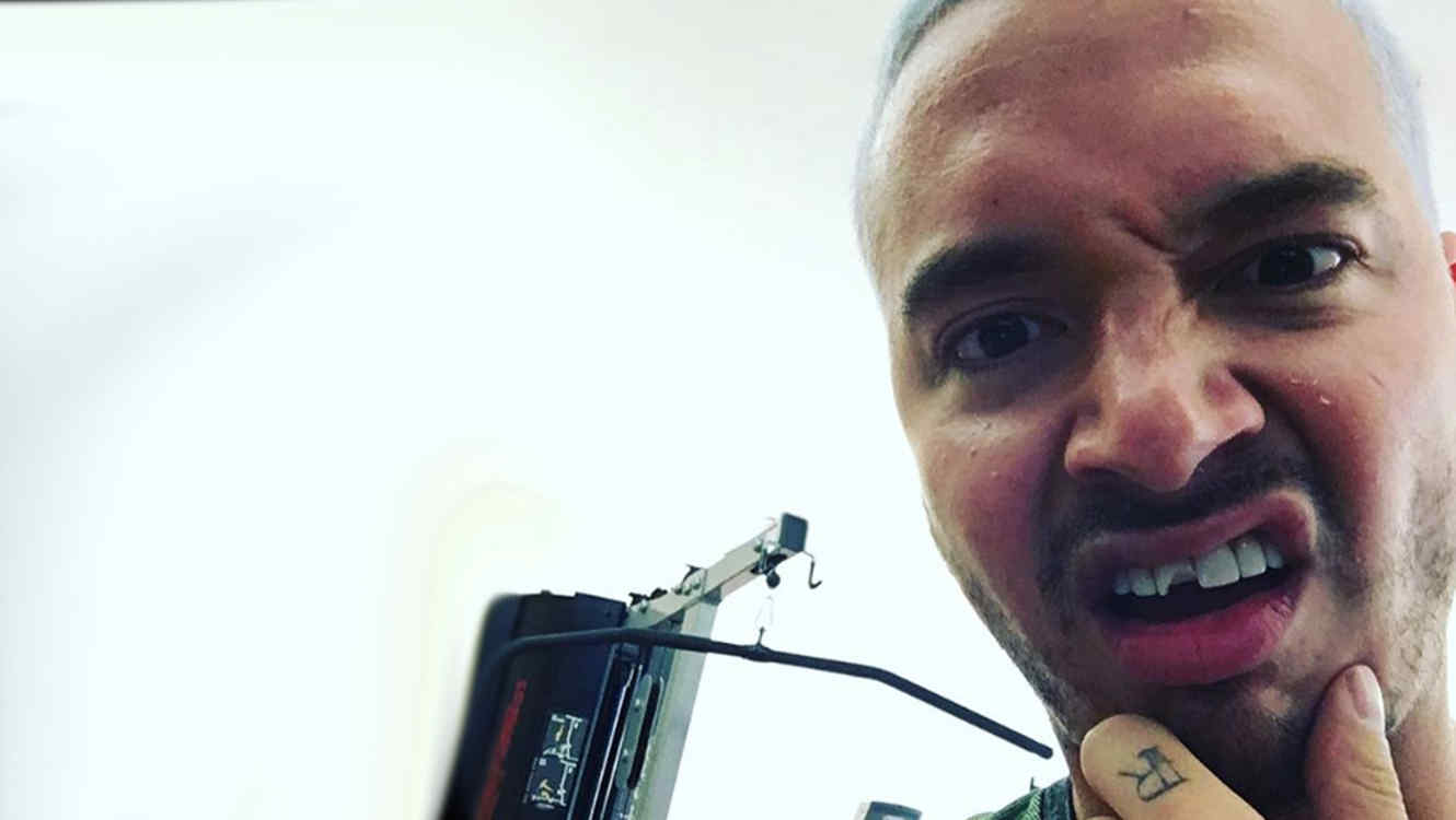 J Balvin nos dice quien es Carlos David 19 J Balvin Sin Diente